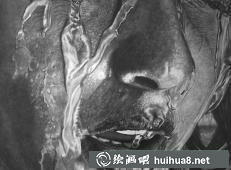 超現(xiàn)實(shí)主義畫(huà)家Paul的素描作品《時(shí)光的印記》